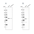 Western blot analysis using Anti-DOK7 antibody HPA062780 (A) shows similar pattern to independent antibody HPA059449 (B).