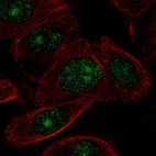 Immunofluorescent staining of human cell line PC-3 shows localization to nucleus & nucleoli.