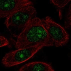 Immunofluorescent staining of human cell line PC-3 shows localization to nucleus & nucleoli.