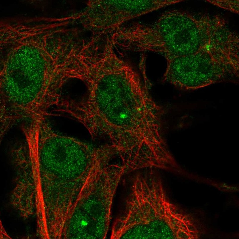 Anti-TMEM169 Antibody