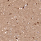 Immunohistochemical staining of human cerebral cortex shows high expression.