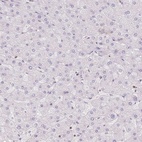 Anti-STK39 Antibody