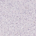 Immunohistochemical staining of human liver shows low expression as expected.