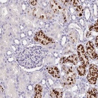 Anti-EML6 Antibody