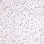 Immunohistochemical staining of human liver shows no positivity in hepatocytes as expected.