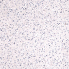 Anti-MSLN Antibody