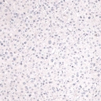 Immunohistochemical staining of human liver shows no positivity in hepatocytes as expected.
