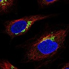 Immunofluorescent staining of human cell line SiHa shows localization to the Golgi apparatus.