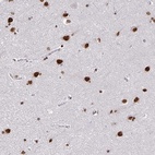 Anti-ZNF579 Antibody