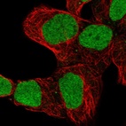 Anti-ZNF579 Antibody