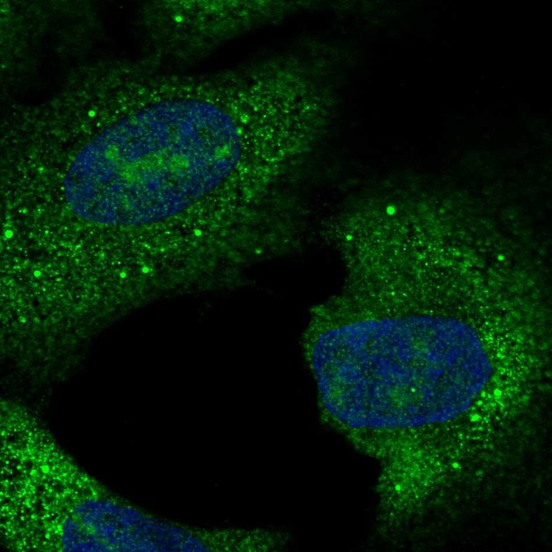Anti-C15orf61 Antibody