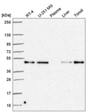 Anti-RELT Antibody