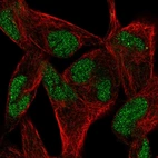 Immunofluorescent staining of human cell line RH-30 shows localization to nucleus.