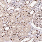 Anti-CAND1 Antibody