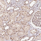 Anti-CAND1 Antibody