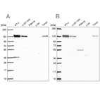 Western blot analysis using Anti-CAND1 antibody HPA062833 (A) shows similar pattern to independent antibody HPA055748 (B).