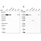 Western blot analysis using Anti-CAND1 antibody HPA062833 (A) shows similar pattern to independent antibody HPA055748 (B).