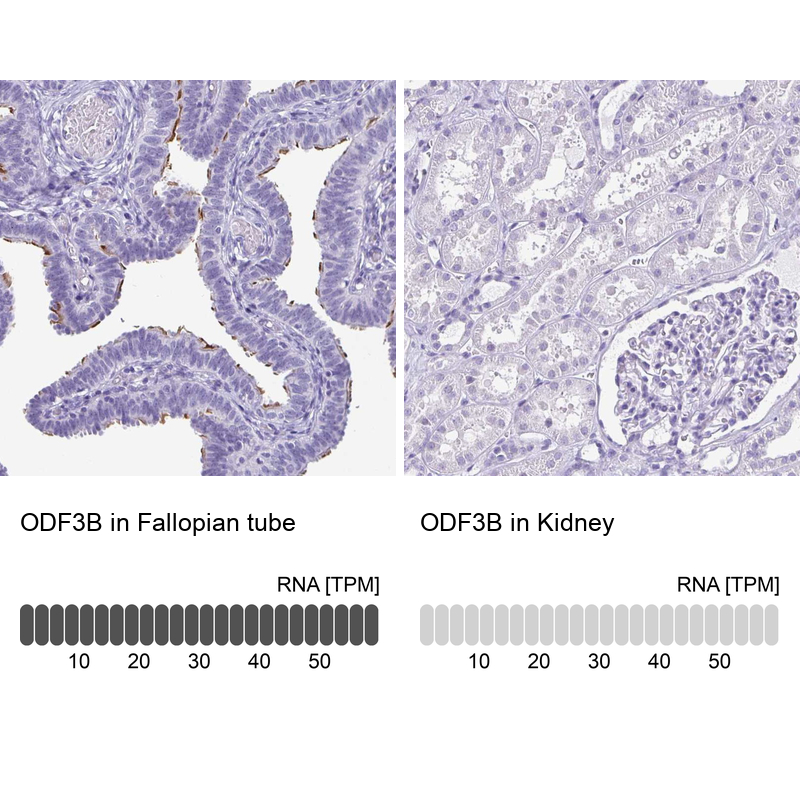 Anti-ODF3B Antibody