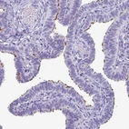 Immunohistochemical staining of human fallopian tube shows high expression.