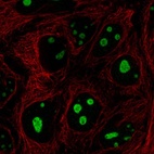 Anti-SREK1IP1 Antibody