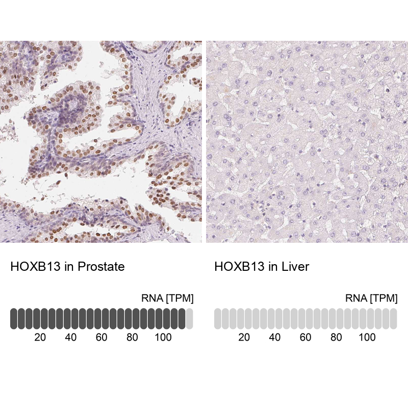 Anti-HOXB13 Antibody