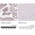 Anti-HOXB13 Antibody