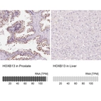 Anti-HOXB13 Antibody