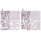 Immunohistochemical staining of human colon, liver, prostate and testis using Anti-HOXB13 antibody HPA062852 (A) shows similar protein distribution across tissues to independent antibody HPA065019 (B).