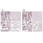 Immunohistochemical staining of human colon, liver, prostate and testis using Anti-HOXB13 antibody HPA062852 (A) shows similar protein distribution across tissues to independent antibody HPA065019 (B).