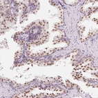 Immunohistochemical staining of human prostate shows strong nuclear positivity in glandular cells.