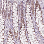 Immunohistochemical staining of human colon shows moderate nuclear positivity in glandular cells.