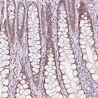 Immunohistochemical staining of human colon shows moderate nuclear positivity in glandular cells.