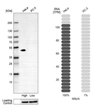 Western blot analysis in human cell lines HeLa and PC-3 using Anti-MSLN antibody. Corresponding MSLN RNA-seq data are presented for the same cell lines. Loading control: Anti-HSP90B1.