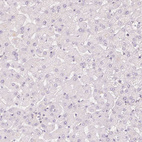 Immunohistochemical staining of human liver shows no nuclear positivity in hepatocytes as expected.
