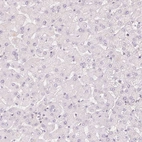 Immunohistochemical staining of human liver shows no nuclear positivity in hepatocytes as expected.