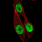 Immunofluorescent staining of human cell line PC-3 shows localization to nucleoplasm.