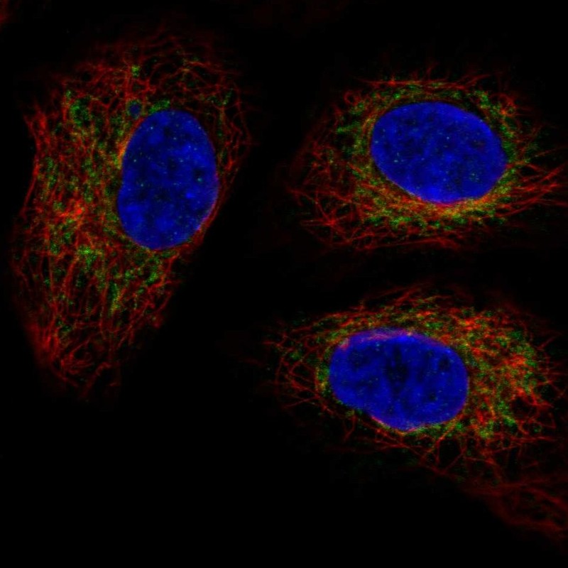 Anti-TMEM11 Antibody