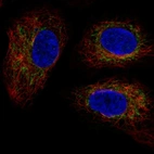 Anti-TMEM11 Antibody