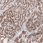 Anti-SMARCB1 Antibody