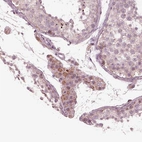 Immunohistochemical staining of human Testis shows moderate cytoplasmic positivity in Leydig cells.