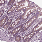 Immunohistochemical staining of human Small intestine shows moderate cytoplasmic positivity in glandular cells.