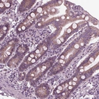 Immunohistochemical staining of human Small intestine shows moderate cytoplasmic positivity in glandular cells.