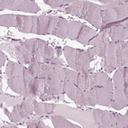 Immunohistochemical staining of human Skeletal muscle shows no positivity in myocytes as expected.