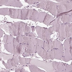 Immunohistochemical staining of human Skeletal muscle shows no positivity in myocytes as expected.