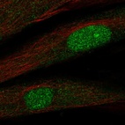 Anti-TWIST2 Antibody