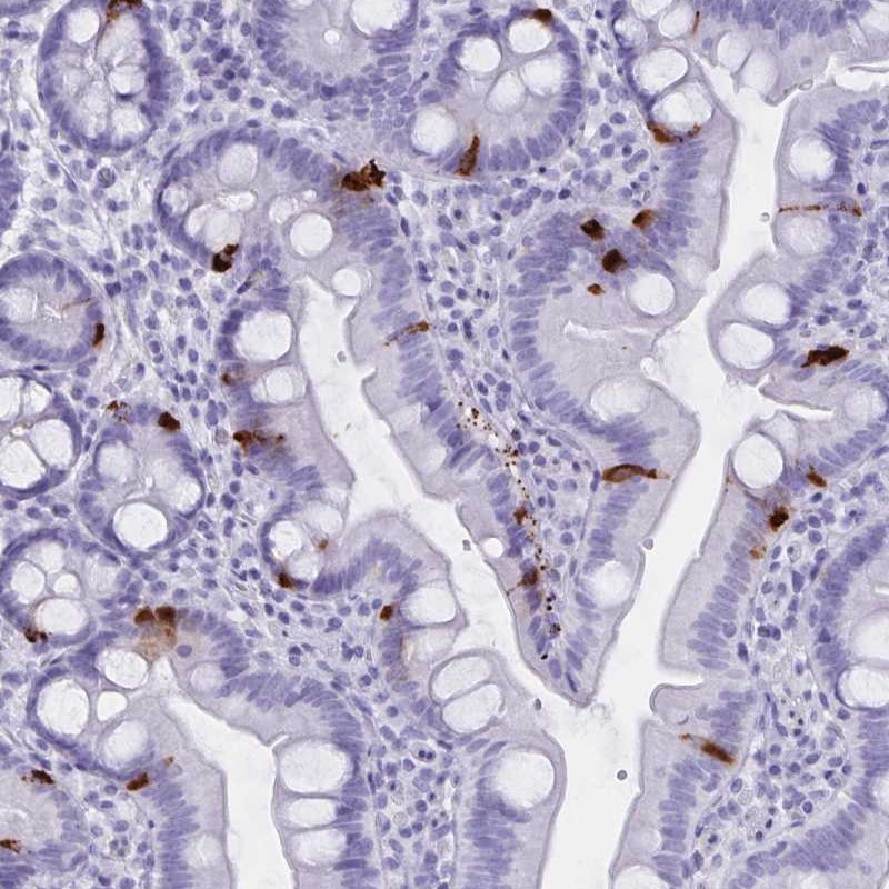 Anti-GPR137 Antibody