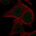 Immunofluorescent staining of human cell line SK-MEL-30 shows localization to nucleoplasm.