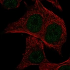 Immunofluorescent staining of human cell line SK-MEL-30 shows localization to nucleoplasm.
