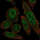 Immunofluorescent staining of human cell line PC-3 shows localization to nucleoplasm & plasma membrane.