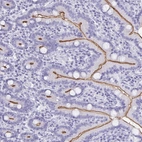 Immunohistochemical staining of human duodenum shows moderate positivity in apical membrane in glandular cells.